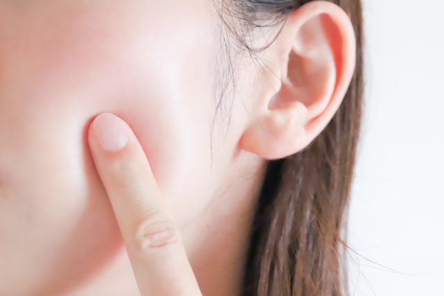 ケミカルピーリング